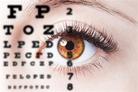 eye exams naples fl.